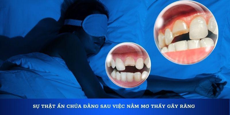Sự thật ẩn chứa đằng sau việc nằm mơ thấy gãy răng